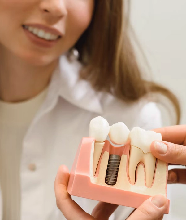 Wisdom tooth removal at Valantine Family Dentistry