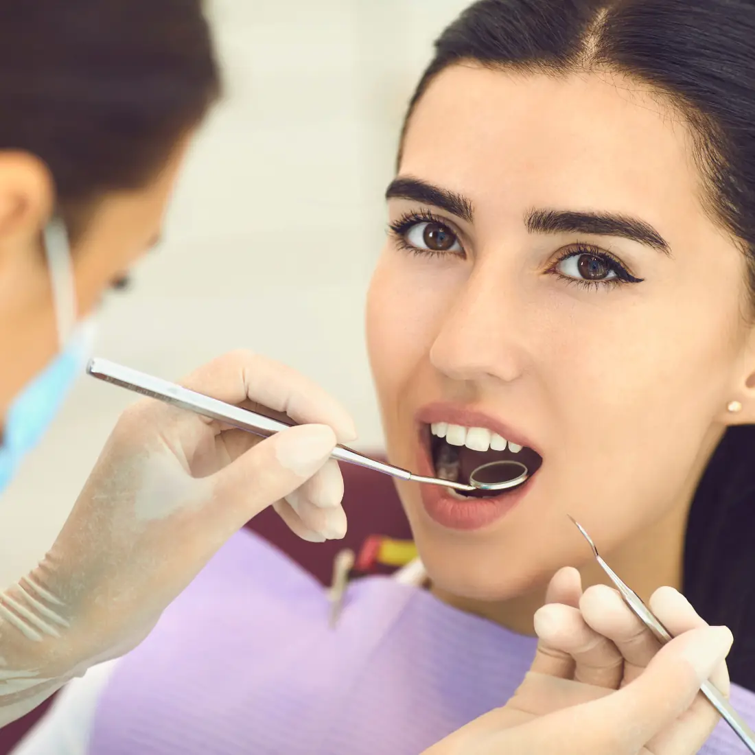 Dental model showing filling restoration with blue curing light.
